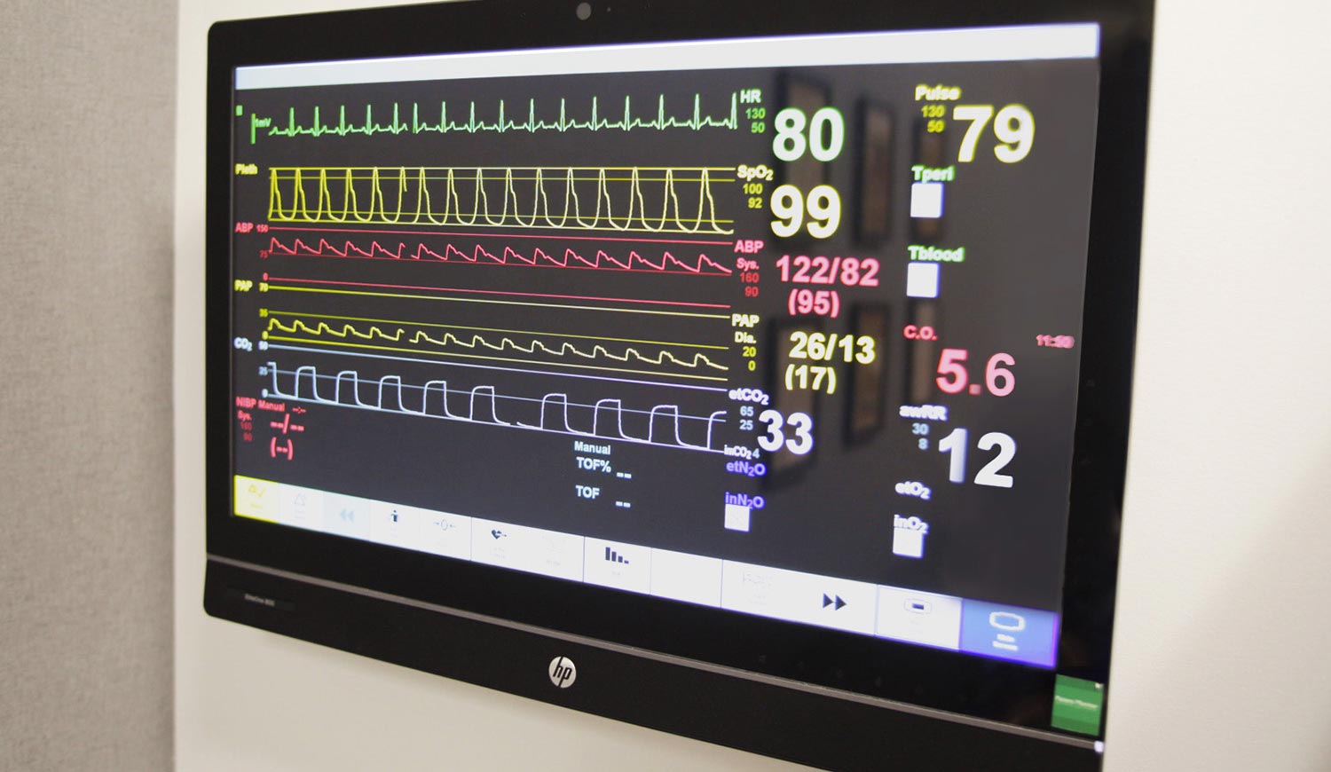 Vital signs displays in each simulation room are driven directly by the simulation software controlling the mannequins, independent of the AV system.